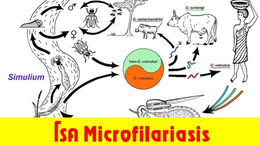 โรค Microfilariasis