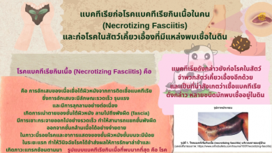 โรคแบคทีเรียกินเนื้อ (necrotizing fasciitis) 